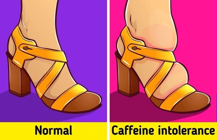 Visage gonflé après consommation de café
