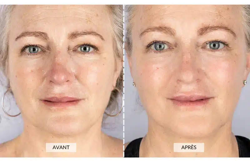 Préparation masque banane tomate