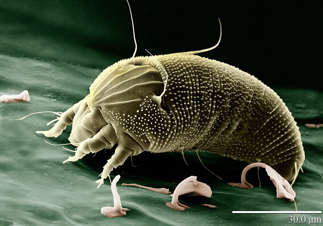 Microscopie d'acariens