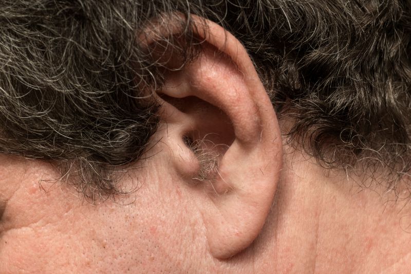 Détail de poils dans l'oreille