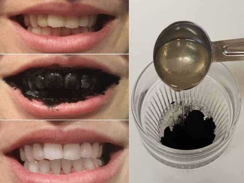 Femme souriante montrant ses dents blanches
