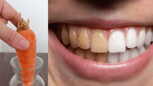 Avantages du dentifrice naturel maison