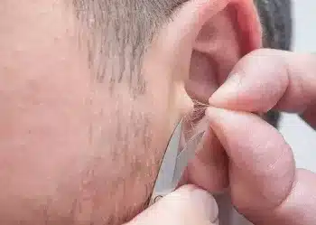 Conduit auditif avec poils