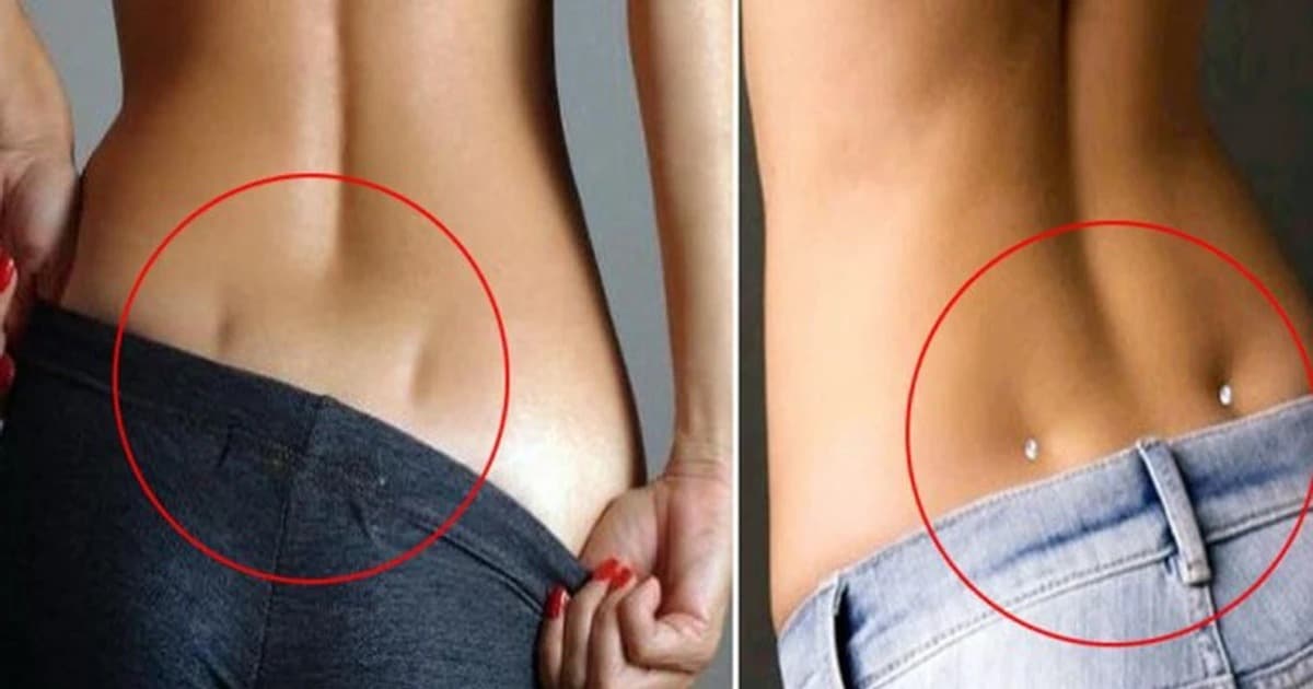 Fossettes lombaires chez un homme