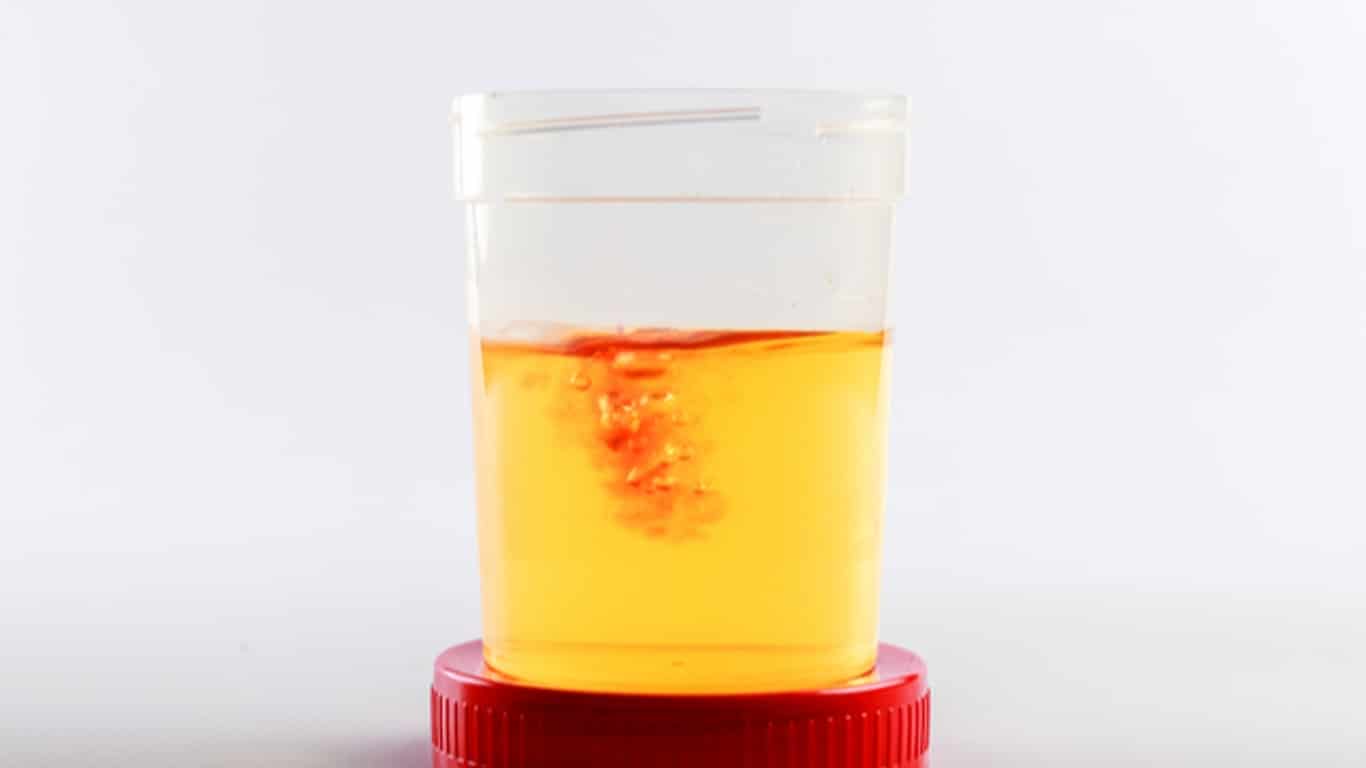 Illustration de symptômes digestifs