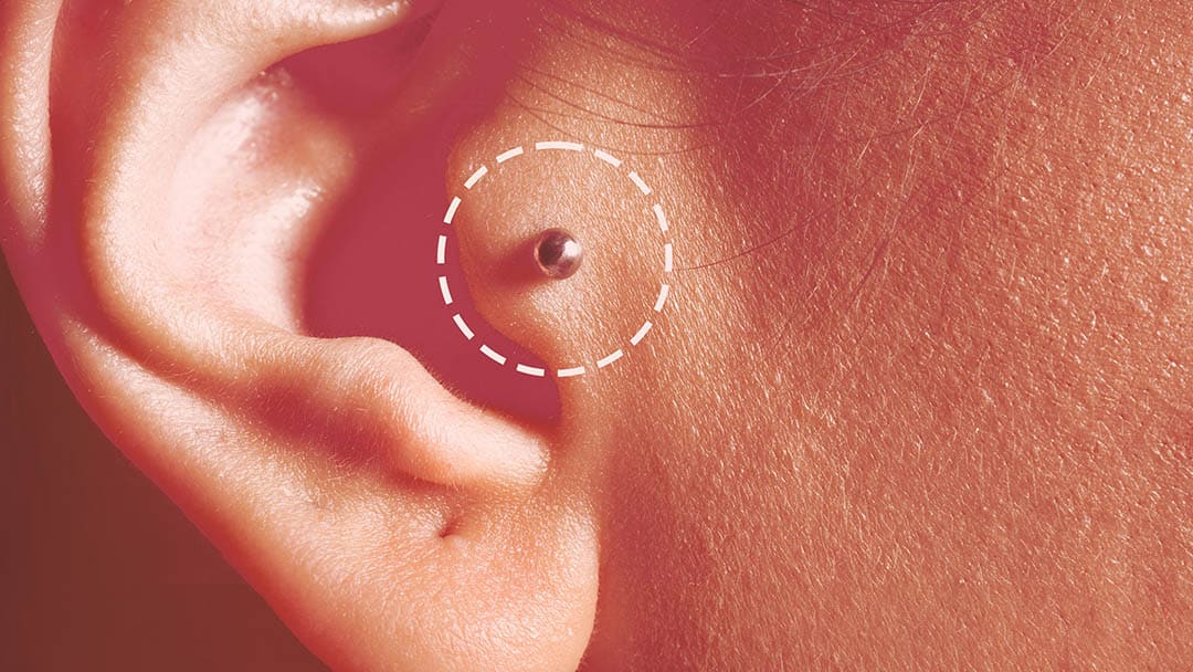 Piercing au tragus - détail esthétique