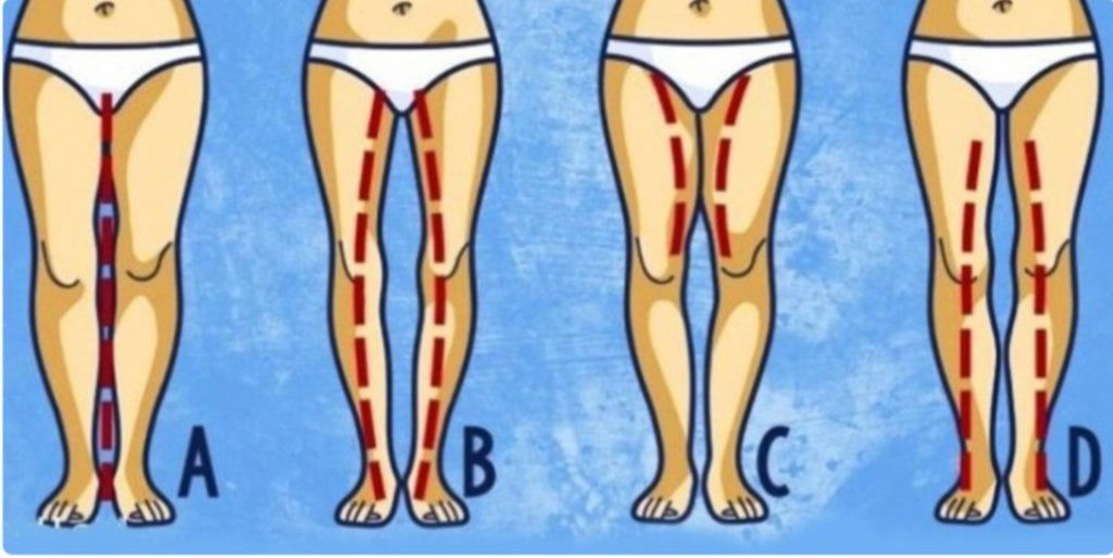 Illustration de différentes morphologies féminines