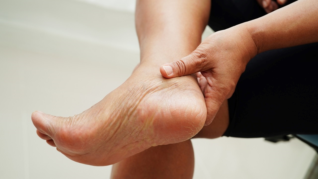 Plante des pieds rouge vif