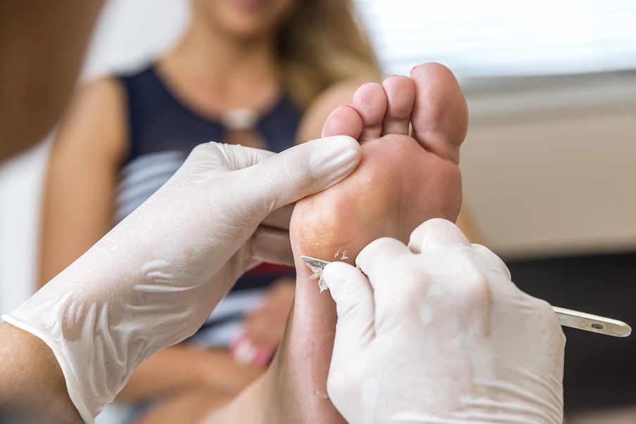 Consultation chez un dermatologue pour verrue persistante