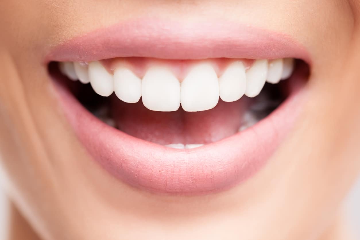 Jeune femme affichant un sourire radieux et des dents blanches