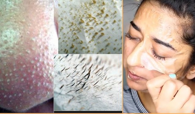 Conseils soins peau