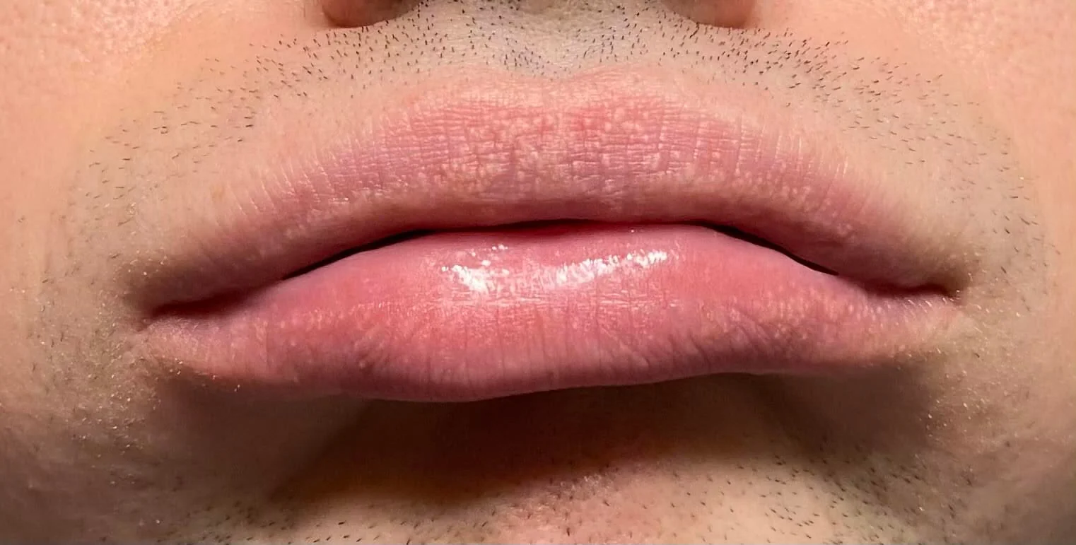 Comparaison visuelle de grains de Fordyce avant et après traitement