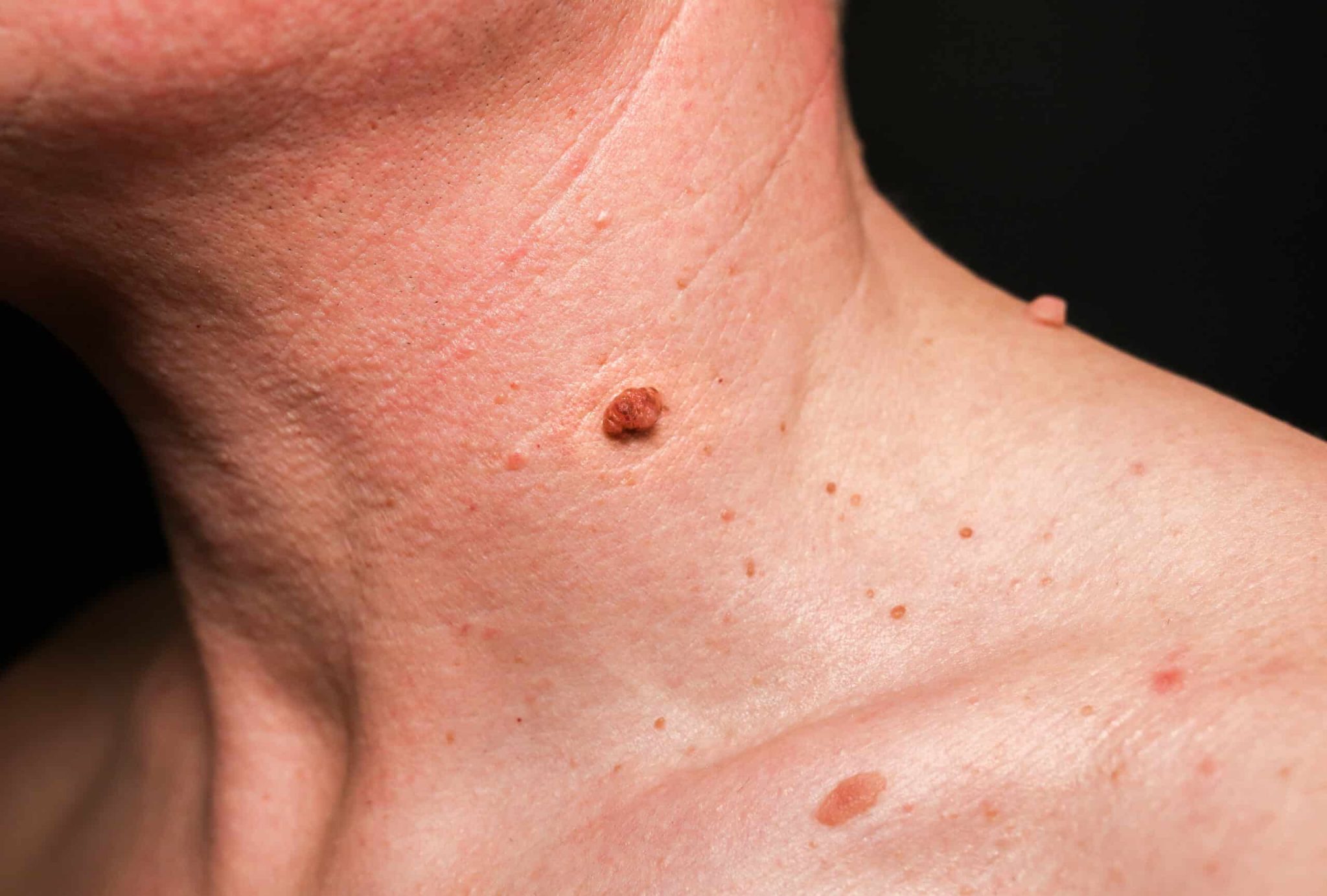 Jeune femme effleurant son visage avec attention, évoquant les questionnements dermatologiques