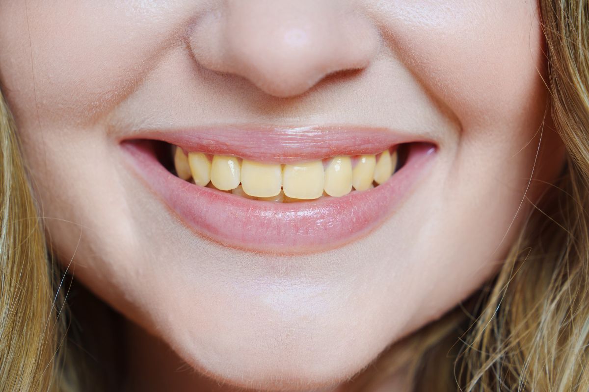 Importance de l'hygiène dentaire et sourire éclatant