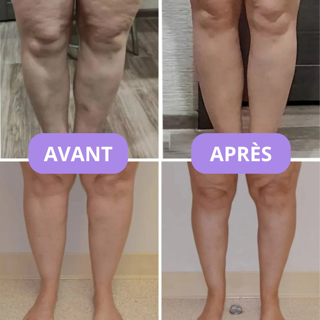 Préparation d'une infusion pour jambes légères
