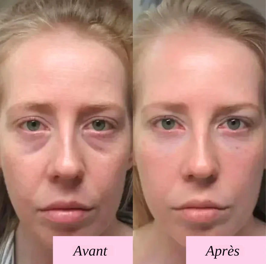 Comparaison avant-après montrant une peau plus lisse et lumineuse