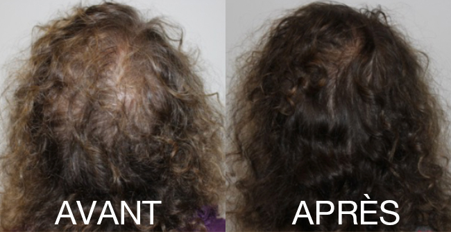 Comparaison visuelle de l'aspect des cheveux avant et après un soin