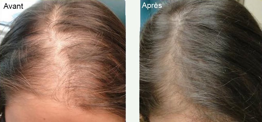 Comparaison avant-après de cheveux, montrant plus de volume et de brillance